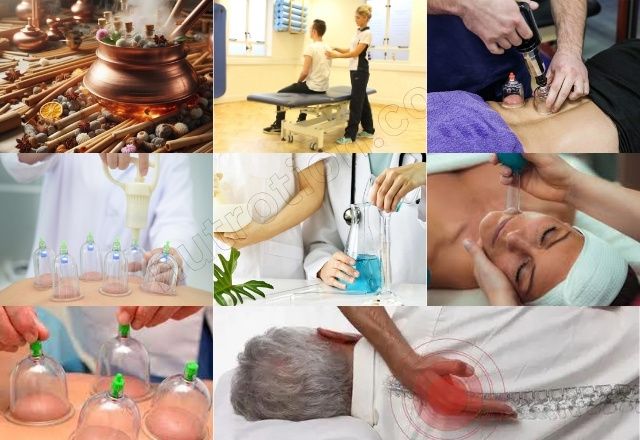 Cupping Therapy: Ancient Practice for Modern Healing